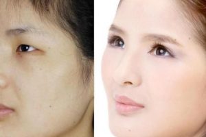 廣西南寧貞韓植發(fā)怎么樣附全新價(jià)格表(價(jià)目表)