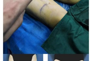 上海交通大學醫(yī)學院附屬第九人民醫(yī)院整形美容科整形價格表一覽及醫(yī)院介紹