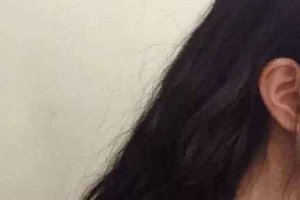 福州渙美醫(yī)療美容門診部整形價格表一覽及醫(yī)院介紹