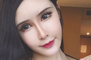 長春榆樹陳偉醫(yī)療美容診所整形價格表(價目表)一覽及醫(yī)院介紹