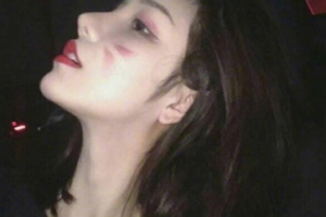 哈爾濱市第一醫(yī)院整形美容科整形價(jià)格表(價(jià)目表)一覽及醫(yī)院介紹