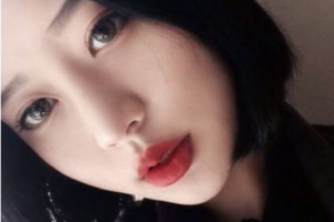 廣西人民醫(yī)院整形美容激光中心整形價格表(價目表)全新發(fā)布