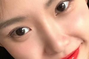 昆明醫(yī)科大學第二附屬醫(yī)院整形外科整形價格表(價目表)一覽及醫(yī)院介紹