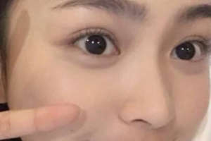 南昌大學(xué)二附院醫(yī)療美容科整形價格表(價目表)全新發(fā)布