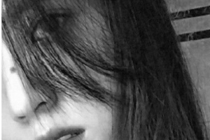 江陰人民醫(yī)院整形美容科整形價(jià)格表(價(jià)目表)全新發(fā)布