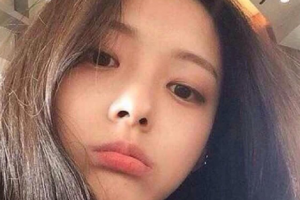 荊門市第二人民醫(yī)院整形外科整形價格表(價目表)一覽及醫(yī)院介紹