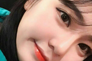 荊門市第一人民醫(yī)院醫(yī)學美容中心整形價格表(價目表)一覽及醫(yī)院介紹