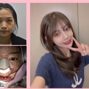 武漢市第三醫(yī)院整形科