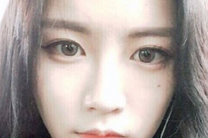 2020北京301整形醫(yī)院整形價(jià)格表(價(jià)目表)公布