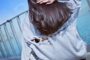 北京美聯(lián)臣美容整形醫(yī)院整形價格表(價目表)2020全新發(fā)布