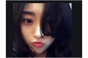 北京大學第一醫(yī)院整形燒傷外科整形價格表(價目表)2020全新發(fā)布