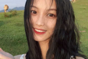 北京大學第三醫(yī)院美容整形科整形價格表(價目表)2020全新發(fā)布