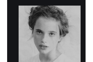 2020佳木斯大學(xué)附屬第二醫(yī)院整形美容外科整形價格表(價目表)全新發(fā)布