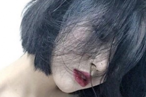 2020成都今妃醫(yī)學美容診所整形價格表(價目表)全新發(fā)布