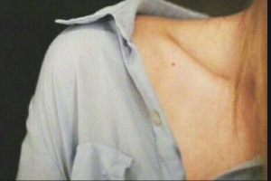 2020義烏芙洛拉醫(yī)療美容門診部整形價(jià)格表(價(jià)目表)全新發(fā)布