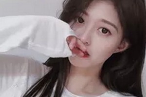 2020長(zhǎng)春西之米醫(yī)療美容醫(yī)院整形價(jià)格表(價(jià)目表)全新發(fā)布