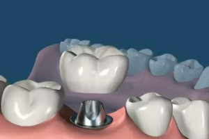 2020佛山順德口腔醫(yī)院整形價(jià)格表(價(jià)目表)全新發(fā)布