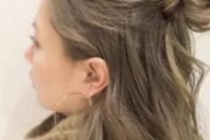 2020大慶生醫(yī)療美容診所整形價格表(價目表)全新發(fā)布