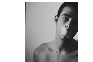 2020深圳市寶安人民醫(yī)院燒傷整形科整形價(jià)格表(價(jià)目表)全新發(fā)布