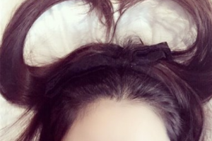 2020北京大學(xué)第三醫(yī)院整形美容外科（北醫(yī)三院）整形價格表(價目表)全新發(fā)布