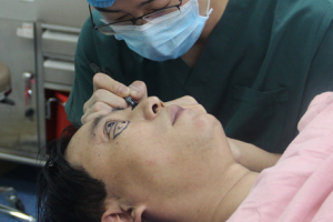 2020金昌市中西醫(yī)結合醫(yī)院眼科整形價格表(價目表)全新發(fā)布