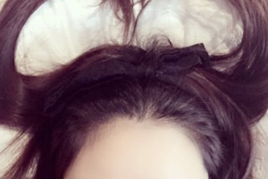 腿部吸脂了解一下！