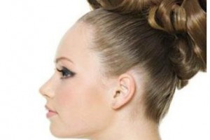 什么是隱耳，隱耳如何矯正