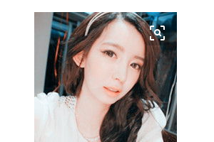 上海仁濟醫(yī)院整形外科陸毅整形價格表附肋軟骨隆鼻案例展示