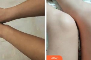 上海天大醫(yī)療美容醫(yī)院邱陽整形價(jià)格表附注射美白案例展示