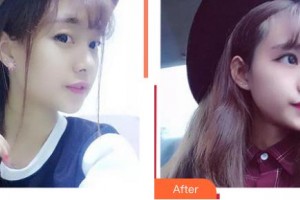 上海萬眾醫(yī)院醫(yī)療美容科金炳國整形價(jià)格表附牛奶酸煥膚案例展示