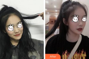 上海天大醫(yī)療美容醫(yī)院盧京鉉整形價格表附無針?biāo)獍咐故?>
</a>
<h3 class=