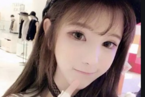 南京友誼整形外科醫(yī)院李明鐘整形價(jià)格表附美白注射案例展示