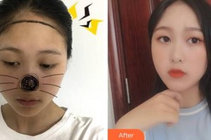 廣州樂鬢毛發(fā)移植中心計(jì)斌整形價(jià)格表附發(fā)際線案例展示