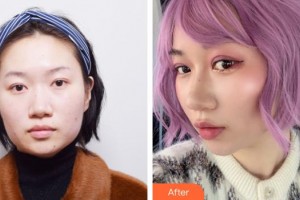 上海一美整形外科醫(yī)院　時峰整形價格表附埋線雙眼皮+去脂案例展示