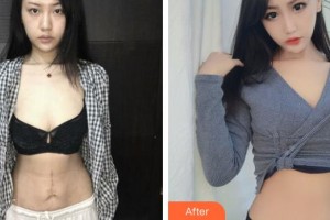 上海麗人整形美容醫(yī)院孔波整形價格表附激光手術祛疤案例展示