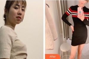 上?？祳W醫(yī)療美容醫(yī)院何玉成整形價格表附光子套餐案例展示