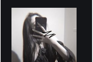 南京華美美容醫(yī)院張曉剛整形價格表附肋軟骨隆鼻案例展示