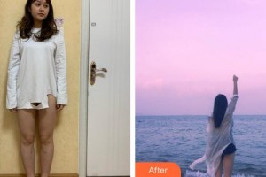 黑龍江省人民醫(yī)院整形美容中心范希明 教授整形價格表附吸脂瘦大腿案例展示