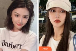 上海宏康醫(yī)院整形美容中心楊慶華整形價格表附面部熱瑪吉案例展示