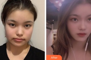 上海華美整形美容醫(yī)院晉孝敏整形價格表附自然V臉型案例展示