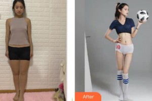 上海閔行區(qū)中醫(yī)院整形外科盧九寧整形價(jià)格表附腰腹環(huán)吸+大小腿吸脂案例展示