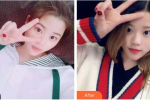 上海藝星醫(yī)療美容醫(yī)院李榮權(quán)整形價(jià)格表附冷光美白案例展示