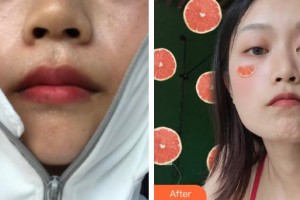 上海藝星醫(yī)療美容醫(yī)院南玉今整形價(jià)格表附光子嫩膚案例展示