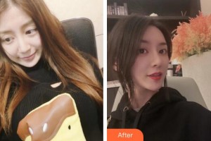 廣州軍區(qū)總醫(yī)院全軍激光整形美容中心吳燕虹整形價格表附鼻修復(fù)+鼻部手術(shù)案例展示