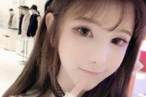 南京市兒童醫(yī)院燒傷整形外科沈衛(wèi)民整形價格表附面部吸脂案例展示