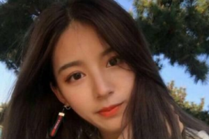 南京鼓樓醫(yī)院整形燒傷外科鄭東風(fēng)整形價格表附硅膠墊下巴案例展示