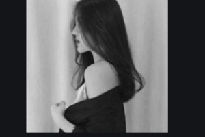 南京華美美容醫(yī)院李耐國整形價格表附硅膠墊下巴案例展示