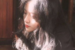 南京華美美容醫(yī)院劉振領(lǐng)整形價格表附瓷貼面案例展示