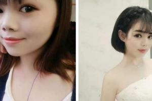 南京東美整形美容醫(yī)院嚴東玲整形價格表附無針水光案例展示