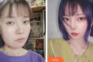 上海瑞麗整形美容醫(yī)院安健榮整形價格表附【水氧活膚】皮膚清潔補(bǔ)水嫩膚案例展示